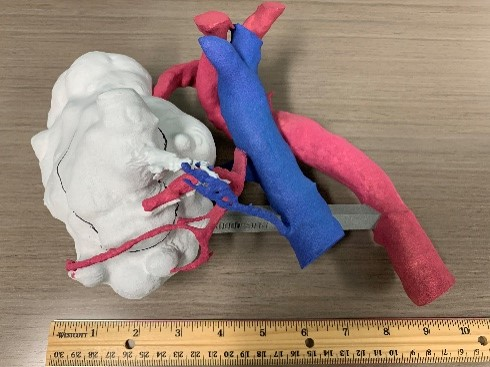 Read From the Collection: Where’s the Tumor?